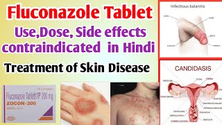 Fluconazole zocon 50mg DT200mg400mgtablet uses side effects dose contraindicated in hindi [upl. by Mylan]