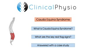 Red Flag Review Cauda Equina Syndrome  Clinical Physio [upl. by Oirasan]