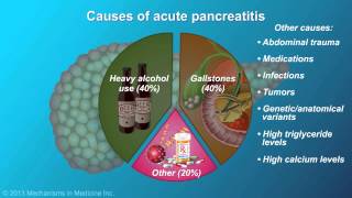 Acute Pancreatitis [upl. by Wulfe297]