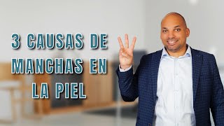 3 CAUSAS de MANCHAS BLANCAS EN EL PIEL ¡Se me está decolorando la piel [upl. by Stella]