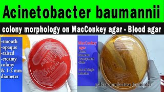 Acinetobacter colony morphology on MacConkey agarBlood agar diagnostic featurespreventive methods [upl. by Trey]