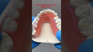 Missing Teeth Heres How to Replace Them satisfying [upl. by Andee]