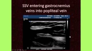 The Importance of Venous Anatomy for the Reflux Ultrasound Examination [upl. by Naujik]