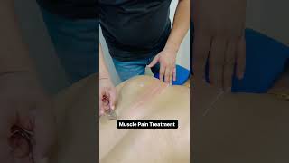 Muscle pain Treatment shorts shortsfeed [upl. by Leonidas525]