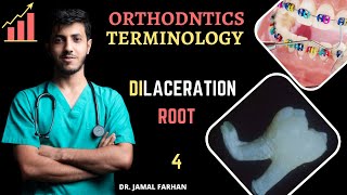 ORTHODONTIC  Lecture 1  Part 4  Dilaceration  كورس تقويم الاسنان [upl. by Reitman]