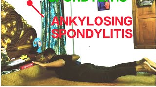 Exercises For ANKYLOSING SPONDYLITIS  ankylosingspondylitis exercise RehabWithArijit painrelief [upl. by Adnuahs441]