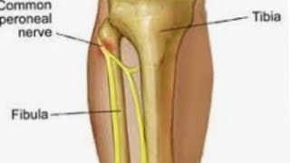 what is common peroneal nerve explained medicalstudent [upl. by Winter]