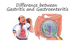 Difference between Gastritis and Gastroenteritis  DrFarzeen Malik  Dr Najam un Nasir [upl. by Nevart]