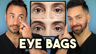 How Treat Under Eye Bags Like A Dermatologist [upl. by Aiksas]