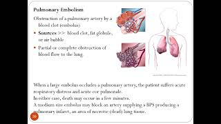 THORAX CLINICALS PPT  Part I  Dr M Kamran Ameer [upl. by Yelhak336]