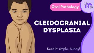 Cleidocranial Dysplasia  Features  Oral Manifestation  Treatment  Oral Pathology  Animated [upl. by Manley197]