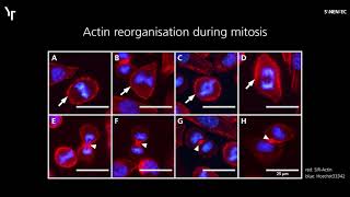 SYNENTEC  Highcontent Imaging of the Actin Cytoskeleton using SiRActin and CELLAVISTA® [upl. by Alliuqat]