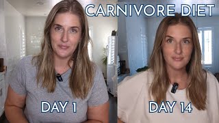 What I Eat for Weight Loss on a Carnivore Diet [upl. by Cherish]