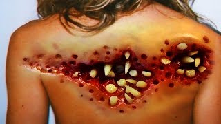 Ten Bizarre Trypophobia Examples by CystBurstingcom [upl. by Elfont312]