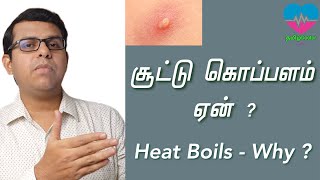 சூட்டு கொப்பளம் ஏன்   Heat Boils  Why  தமிழ் [upl. by Sollie]