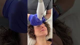 Nonsurgical Eye lift with Thermage FLX  The Cosmetic Skin Clinic [upl. by Chrystel493]