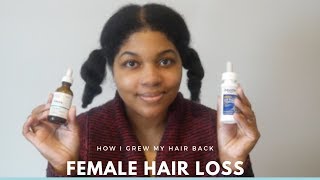 FEMALE HAIR LOSS  How I Grew My Hair Back  UPDATE [upl. by Huxley287]