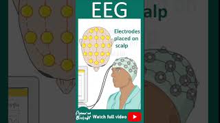 EEG  Electroencephalogram  How EEG works  1 minute pathology [upl. by Aenat]