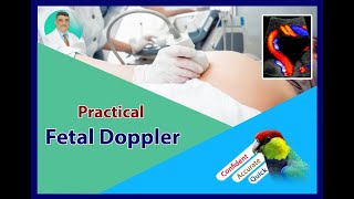 Introduction to Practical Obstetric Doppler [upl. by Itoc]