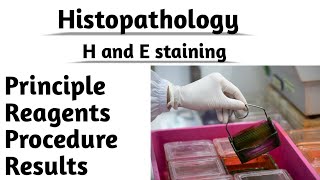 Histopathology H and E staining Principle reagents Procedure Results Tissue staining [upl. by Eirol173]