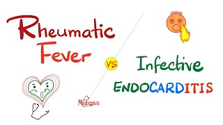 Rheumatic Fever vs Infective Endocarditis  Comparison  Cardiology Series [upl. by Adamik]