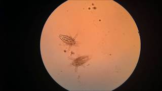 Zooplankton in the Microscope [upl. by Rosemary929]