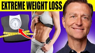 The Ultimate Fat Burning Guide Dr Bergs Webinar on Maximum Weight Loss [upl. by Neyud]