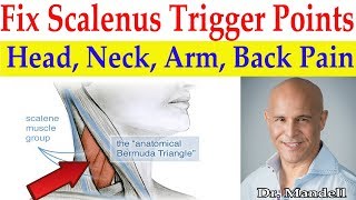 Fix Scalenus Trigger Points Quick Relief to Head Neck Arm Upper Back Pain  Dr Alan Mandell DC [upl. by Holcman590]