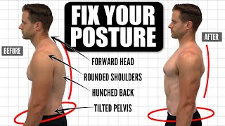 How To FIX Your Posture  10Minute Daily Routine [upl. by Grishilda239]