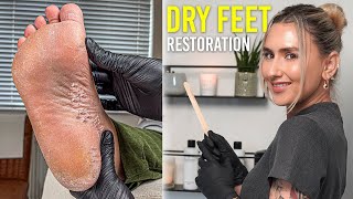 Restoring Dry Cracked Feet And Heels SATISFYING [upl. by Oneladgam]