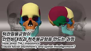 How does TMJ imbalance cause facial asymmetry and spinal misalignment 3D images [upl. by Pazice]