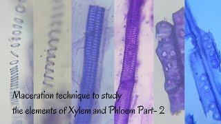 Maceration Technique to Study the Elements of Xylem amp Phloem Part2 [upl. by Atnovart]