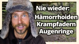 Nie wieder Hämorrhoiden Krampfadern amp Augenringe Diese Heilpflanze wirkt Wunder [upl. by Ainit]