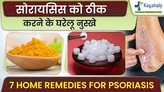 Psoriasis Causes Symptoms Types In Hindi  सोरायसिस क्या है क्यूँ होता है कारण लक्षण प्रकार [upl. by Alya]