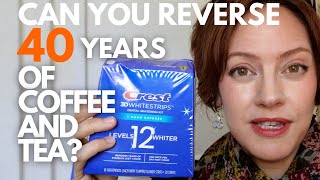 Crest Whitening Strips Review  Before and After Sensitivity Effective [upl. by Dranoc423]