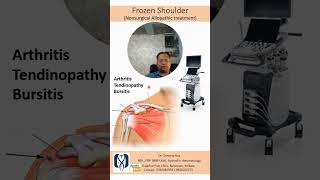 Frozen shoulder shoulder pain treatment [upl. by Ahc]