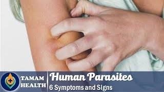 6 Symptoms of Human Parasites Everyone Should Know [upl. by Caryl]