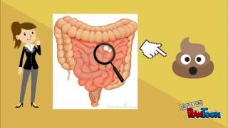 Ciclo de vida de strongyloides stercoralis [upl. by Olag]