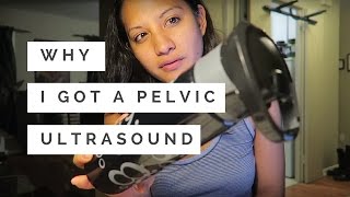 Why I got a Pelvic Ultrasound  Tamoxifen  Breast Cancer [upl. by Ecinuahs]