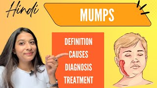 Mumps  Symptoms diagnosis Treatment  Explained easily in Hindi [upl. by Rosene91]