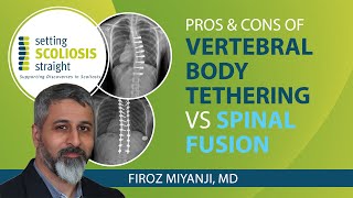 Pros and Cons of Vertebral Body Tethering vs Spinal Fusion [upl. by Silas]