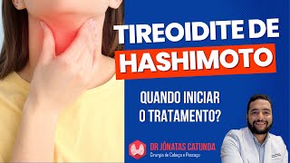 Tireoidite de Hashimoto Quando iniciar o tratamento [upl. by Deloris]