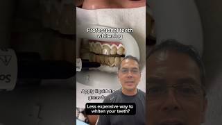 Professional Teeth Whitening vs Hydrogen Peroxide EXPLAINED  In Office to Hands On Dental Training [upl. by Ahseat]