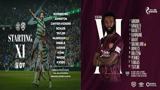 Celtic Vs Hearts BBC Radio [upl. by Redep198]