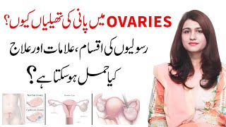 Anda Dani Ki Rasoli Ka Ilaj  Ovarian Cyst Signs And Symptoms  Dr Maryam Raana Gynaecologist [upl. by Ocirrej]