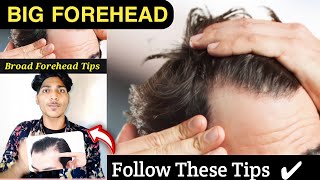 Big Forehead Tips  Receding Hairline  shorts  Big Forehead Hairstyles  ytshorts hairloss [upl. by Erikson]