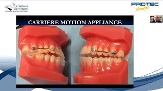 WEBINAR Carriere Motion Appliance [upl. by Magbie614]