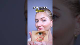 eye bags gone🔥 eyebags faceexercises faceyoga facefitness facemassage [upl. by Radbun]