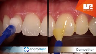 Enamelast™ fluoride varnish vs Competitor varnish [upl. by Timms]