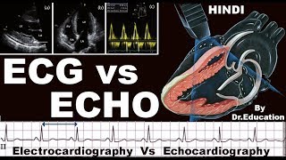 Rx Heart epi 16 h  ECG vs ECHO HINDI Electrocardiography vs Echocardiography DrEducation [upl. by Janet800]